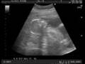Nuestro Bebe 19 semanas