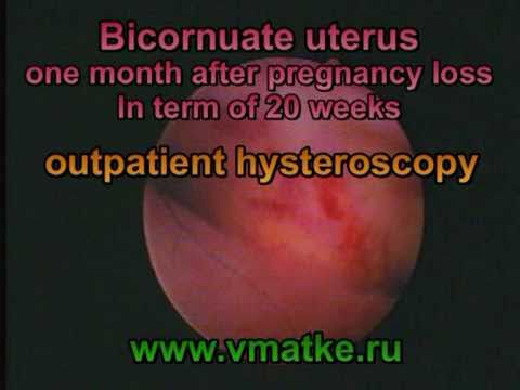 how to treat amniotic fluid leak