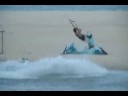 Kiteloop mobe crash to torn ACL.