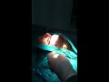 Sebaceous cyst excision