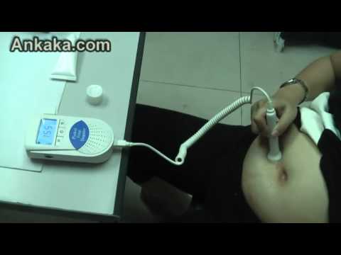 how to locate fhr