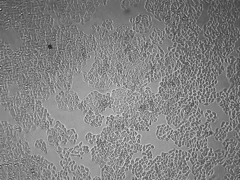 Hep3B cells growths by using JuLI Br