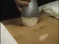 VelaShape VelaShape