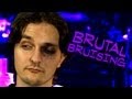 Brutal Bruising: Mad Monster Lab