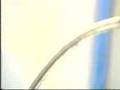Thermal Depolymerization