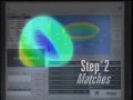 Custom Wavefront LASIK with Dr. Boxer Wachler Custom Wavefront LASIK with Dr. Boxer Wachler