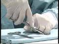 videos de foarfeca corect finete
