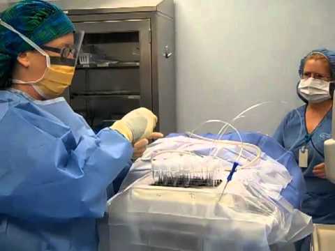 how to fertilize turkey eggs
