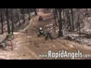 quads