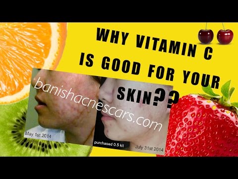 how to use vitamin c on your skin