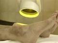 Bioptron Polarized Light Therapy