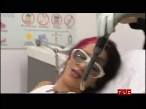 Laser tattoo removal - Dr. Will Kirby removes a tattoo from Pixie Acia's 