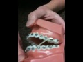 Class 3 elastics
