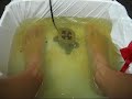 What does Foot Detox Do? Day 9 What does Foot Detox Do? Day 9