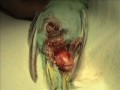 Oviposición infructuosa Oviposición infructuosa