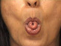 Yoga for Migraine Headaches : Yoga Cooling Breaths for Migraines Yoga for Migraine Headaches : Yoga Cooling Breaths for Migraines