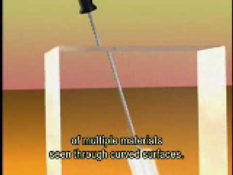 how to perform cycloplegic refraction