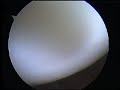 Scopie Knie