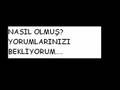 g�zlerimin etrafindaki �izgiler