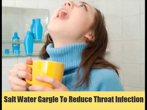 how to cure throat infection