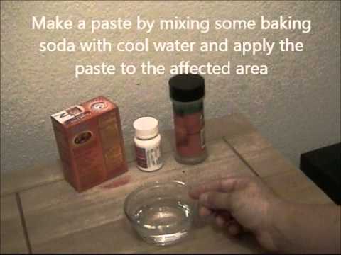 how to relieve bee sting