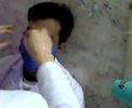 Ophthalmology Practice(IOP 1) Ophthalmology Practice(IOP 1)
