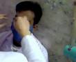 Ophthalmology Practice(IOP 1)