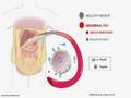Belly Fat Linked To Type-2 Diabetes