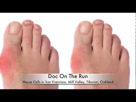 how to relieve gout in the foot