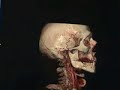 Heart Scan of Chicago