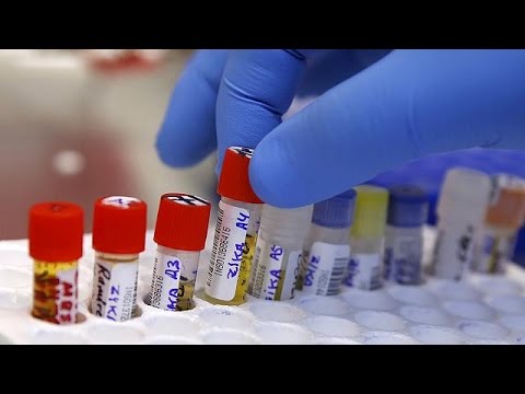 Estados Unidos anuncia un caso de transmisión del zika por vía sexual
