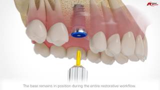 Jose Enrique Reche Benitez-9