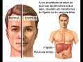 Doen�as