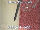 Laser Periodontal Therapy Long Island | Periodontal Laser Therapy Suffolk Nassau | Laser Gum