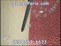 videos de Laser Periodontal Therapy Long Island | Periodontal Laser Therapy Suffolk Nassau | Laser Gum