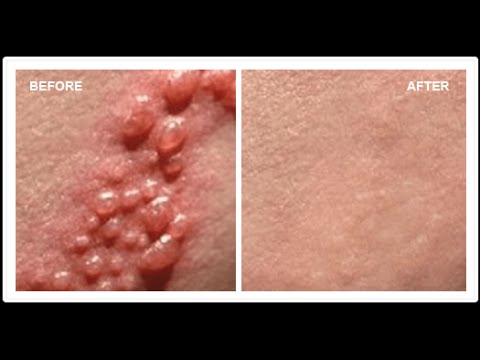 how to whiten synthetic underwear