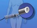 PreOp® Patient Education Laparoscopy Diagnostic Surgery Laparoscopy