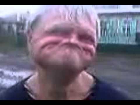 Ugliest person