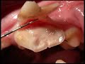 Advances in Pet Dentistry