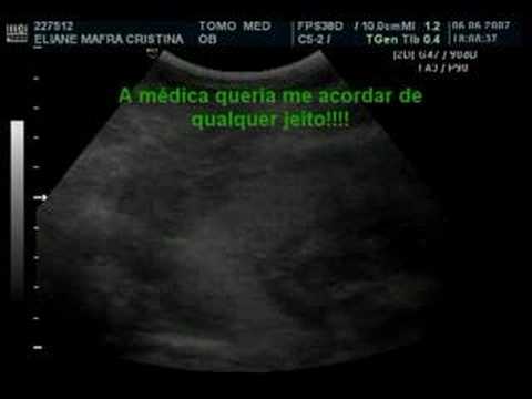 Ultrassom