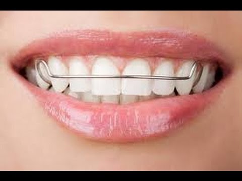 how to whiten retainers