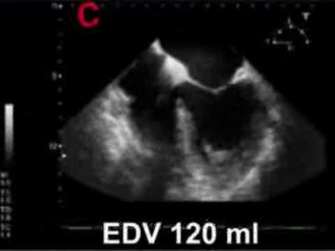 how to assess volume status