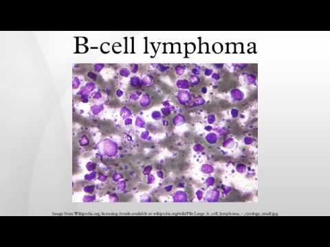 how to cure b cell lymphoma