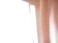 Cat Attack