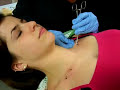 Thumbnail #1