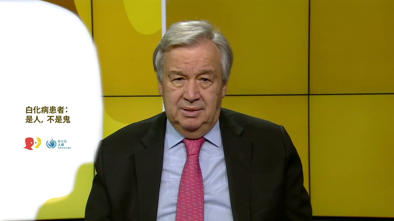 День распространения информации об альбинизме