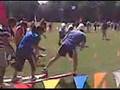 Operation Olympics (Ethicon)