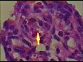 Cryptosporidium parvum-infected tissues and fecal sample Cryptosporidium parvum-infected tissues and fecal sample