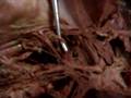 Celiac, Hepatic, Gastric, Spleenic arteries