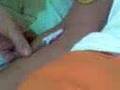 doando sangue